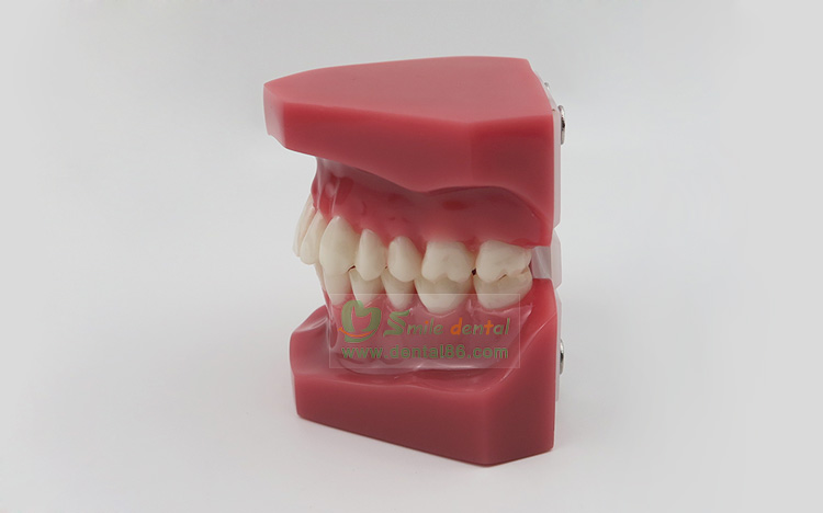 Orthodontic Model